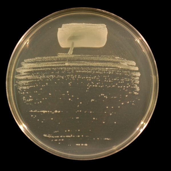 توکسین بایندر | خوراک دام | خوراک طیور |