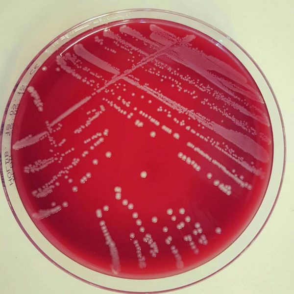 مراکسلا کاترهالیس (Moraxella catarrhalis)