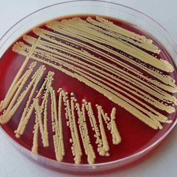 میکروکوکوس لوتوس (Micrococcus luteus) 1 میکروکوکوس لوتوس (Micrococcus luteus)