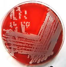 (استافیلوکوکوس آرئوس) Staphylococcus aureus TPCC8861